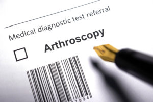 Arthroscopy Benefits