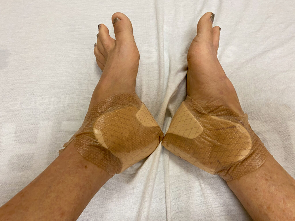 Ankle replacement surgery