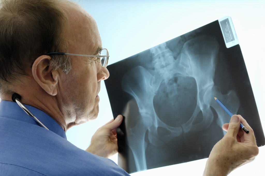Orthopedic Surgeon Analysing X-ray