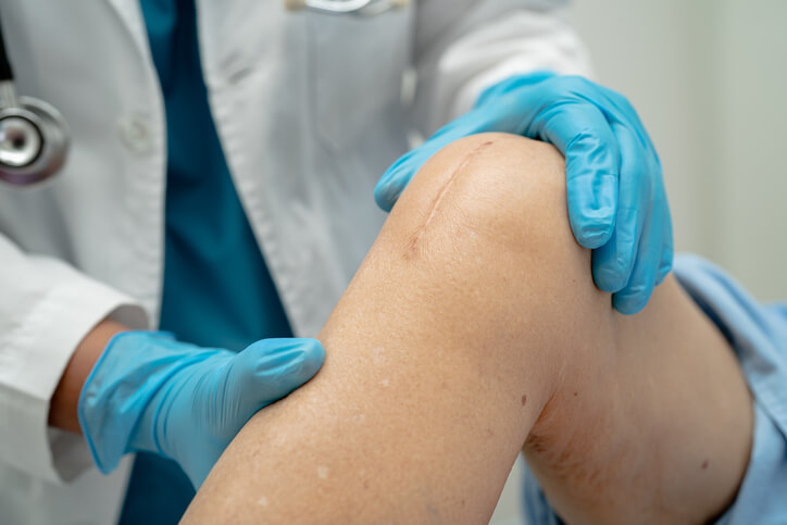 oman patient scars surgical total knee joint replacement Suture