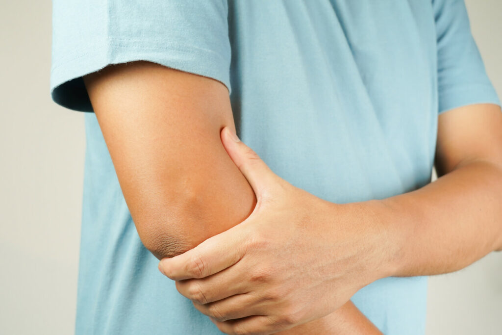 Image of a person suffering from tennis elbow, a condition causing pain in the elbow, with a focus on bone arthritis.